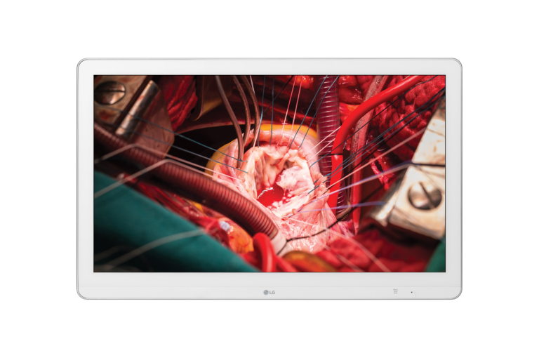LG 27'' Full HD IPS Surgical Monitor Monitor per Sala Operatoria