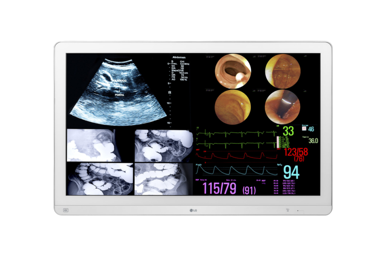 LG Monitor per Sala Operatoria Surgical Monitor 31.5″ 4K IPS 12G-SDI Support