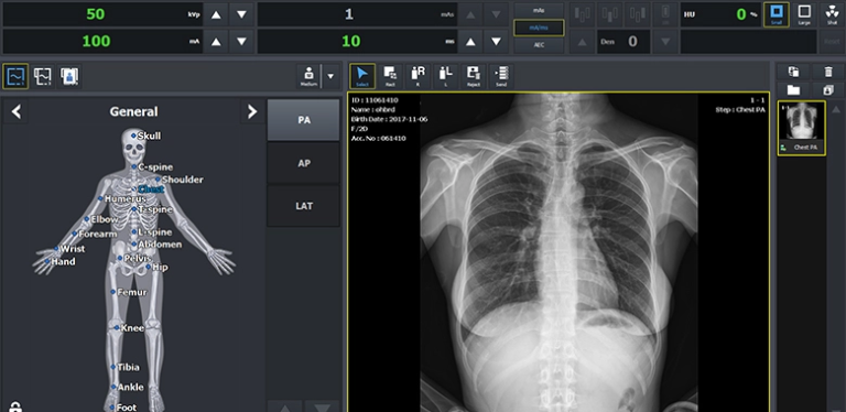 Software VXvue Vieworks Radiologia Umana