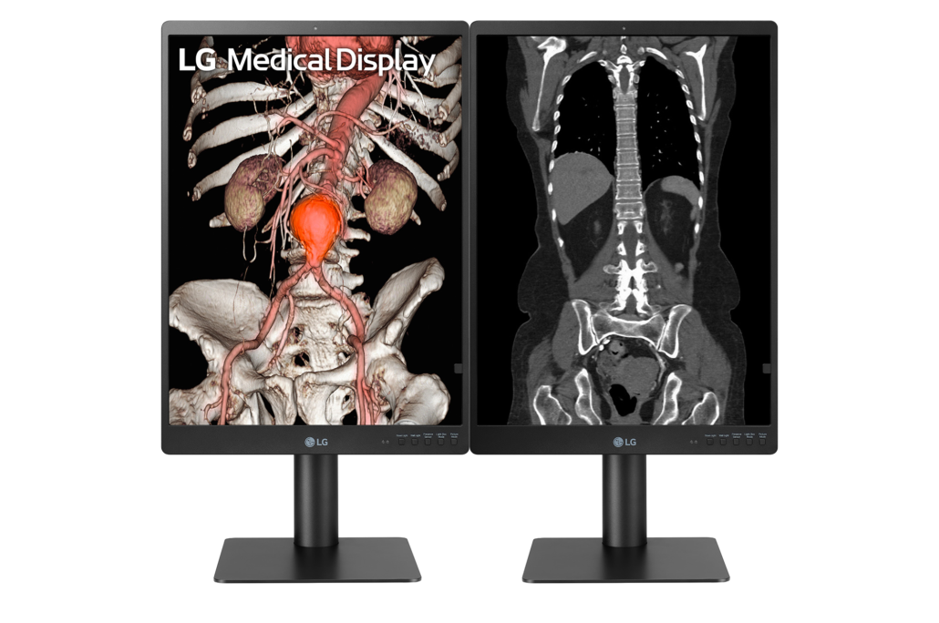 LG Diagnostic Monitor 21″ 3MP IPS Monitor Diagnostico