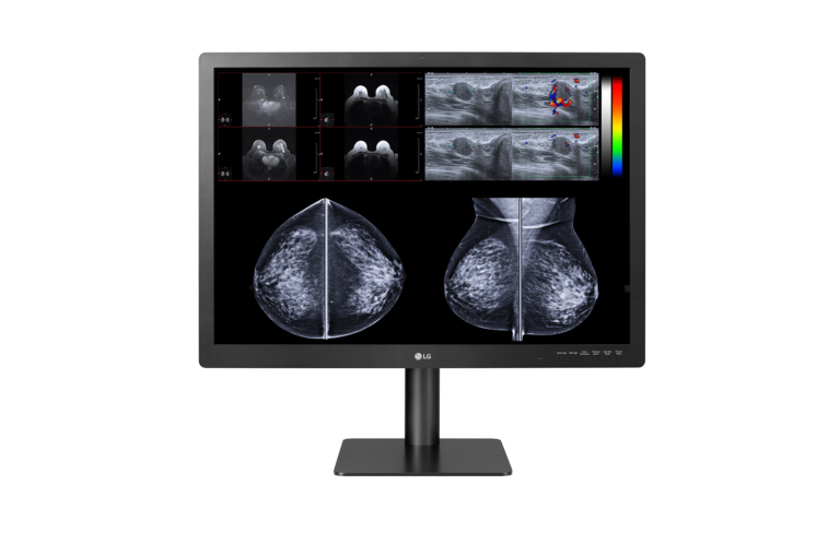 LG Monitor Diagnostico 31″ 12MP IPS per Mammografia
